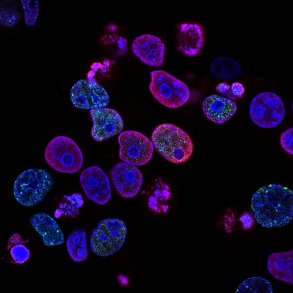 Plasmodium parasite